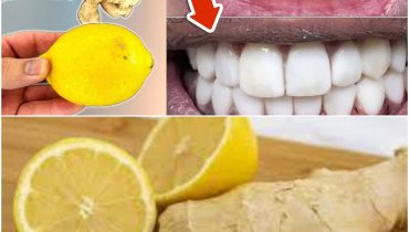home mix paste remedies smile 